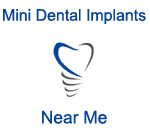 Mini Dental Implants Near Me